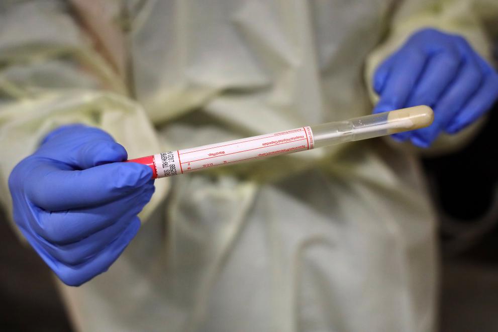 Koronavirus: Komisija predložila pravila o brzim testovima na antigene i osigurala 20 milijuna testova za države članice